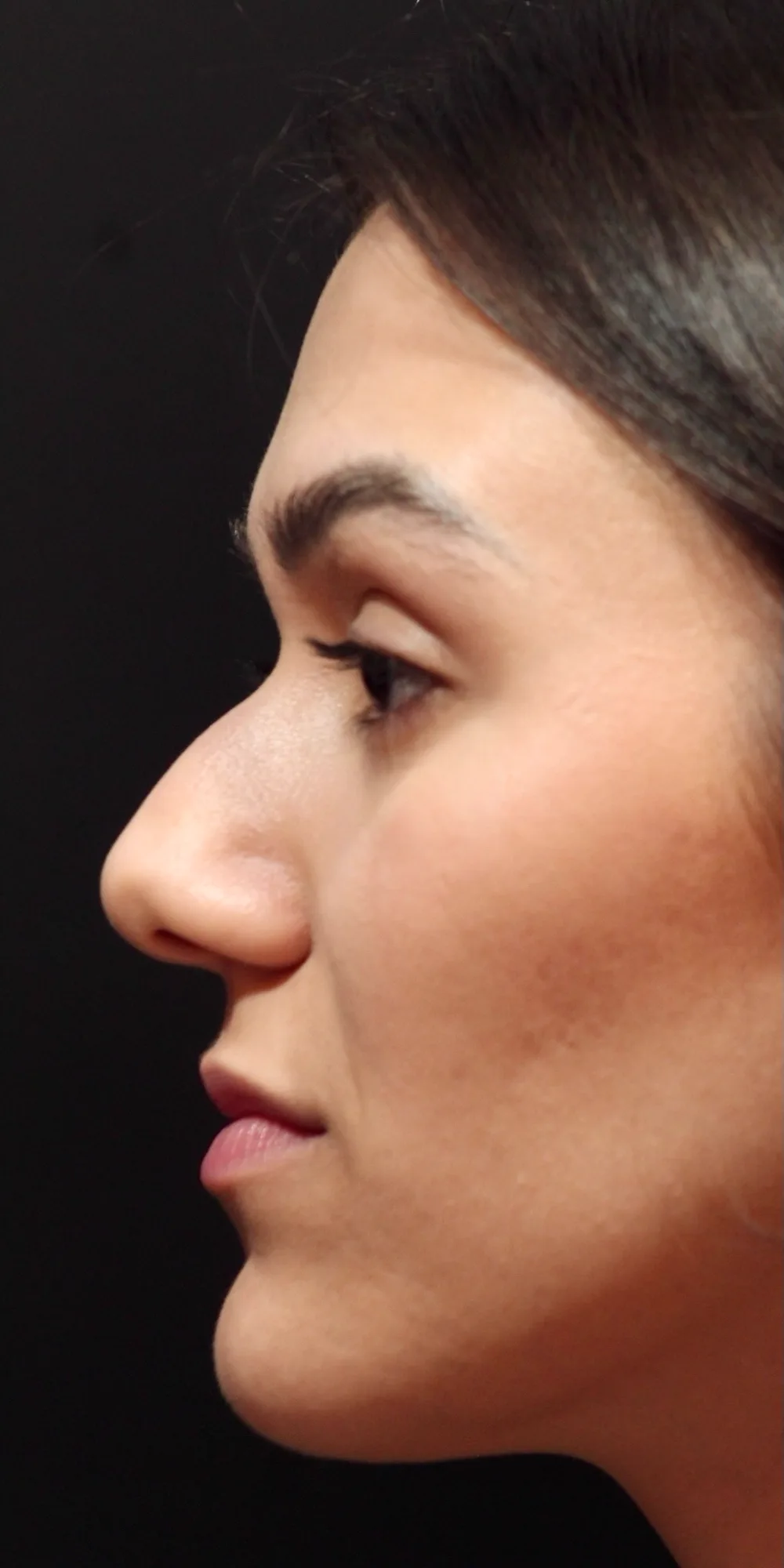Antes: paciente de perfil